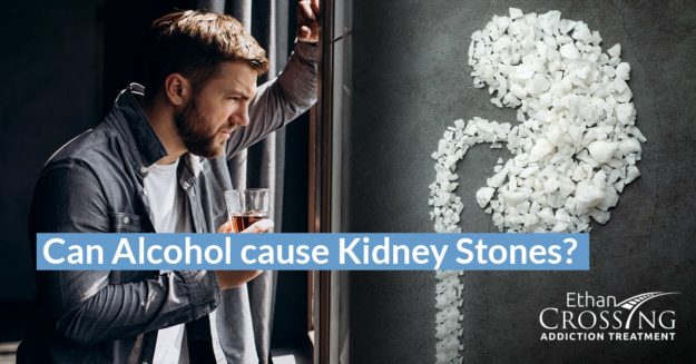 Can Alcohol Cause Kidney Stones_- Featured Image-min alcohol and kidney stones
