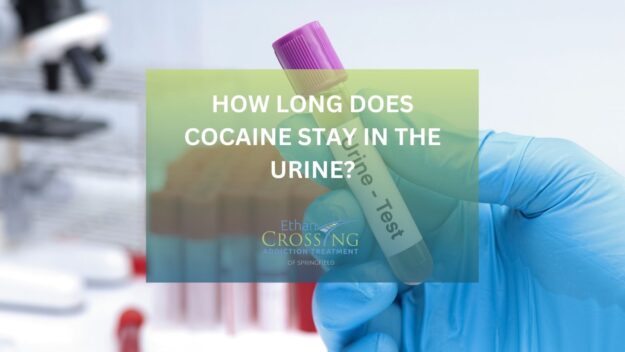 How Long Does Cocaine Stay in the Urine